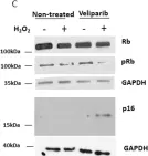 Fig.7.C showing Western Blotting from the publication: The out-of-field dose in radiation therapy induces delayed tumorigenesis by senescence evasion.
