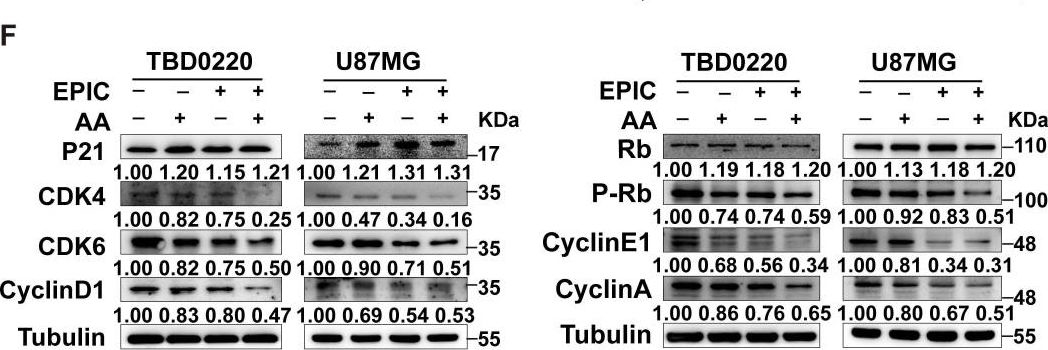 Fig.3.F showing Western Blotting from the publication: TCA-phospholipid-glycolysis targeted triple therapy effectively suppresses ATP production and tumor growth in glioblastoma.