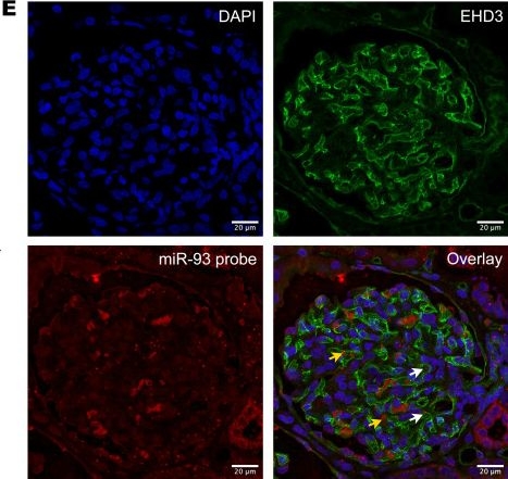 Fig.1.E showing Immunohistochemistry-immunofluorescence in a Homo sapiens (Human) sample from the publication: Extracellular vesicle miR-93-5p cargo regulates glomerular endothelial cell damage in Alport syndrome.
