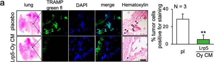 Fig.3.A showing Immunohistochemistry-immunofluorescence from the publication: Induced Tumor-Suppressing (iTS) Cell-Based Approach for Protecting the Bone from Advanced Prostate Cancer.