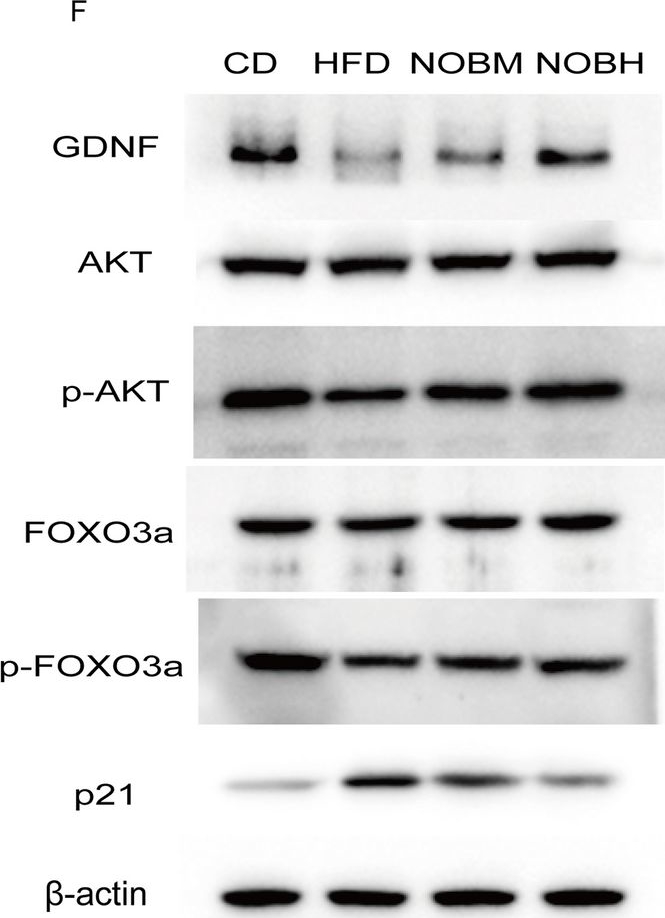 Fig.5.F showing Western Blotting from the publication: Nobiletin restores HFD-induced enteric nerve injury by regulating enteric glial activation and the GDNF/AKT/FOXO3a/P21 pathway.