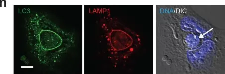 Fig.1.N showing Immunocytochemistry in a Homo sapiens (Human) sample from the publication: Mitosis can drive cell cannibalism through entosis.
