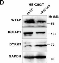 Fig.10.D showing Western Blotting in a Homo sapiens (Human) sample from the publication: WTAP tetramer ensures m6A writer assembly and faithful mitosis.