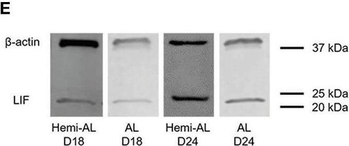 Fig.2.E showing Western Blotting from the publication: Allogeneic Embryos Disregulate Leukemia Inhibitory Factor (LIF) and Its Receptor in the Porcine Endometrium During Implantation.