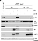 Fig.5.C showing Western Blotting in a Homo sapiens (Human) sample from the publication: Computational and Functional Analysis of Structural Features in the ZAKα Kinase.