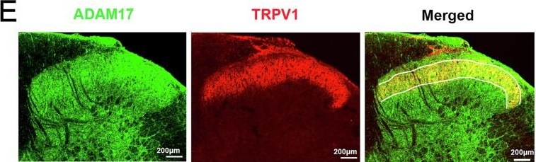 Fig.2.E showing Immunohistochemistry-immunofluorescence in a Rattus norvegicus (Rat) sample from the publication: Xpro®1595 alleviates neuropathic pain by targeting spinal dorsal horn ADAM17-mediated inflammation.