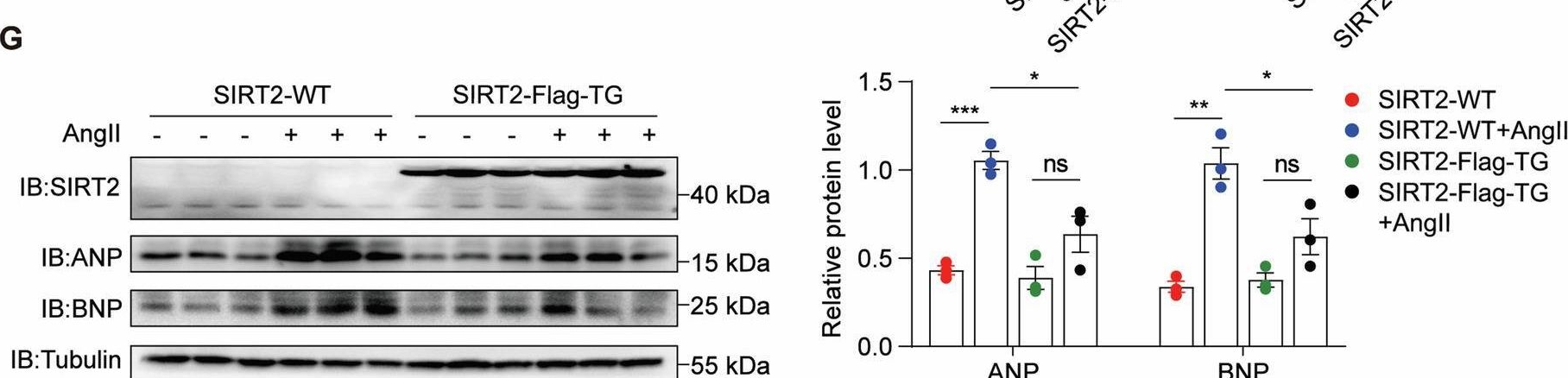 Fig.5.G showing Western Blotting in a Mus musculus (House mouse) sample from the publication: Positive feedback loop involving AMPK and CLYBL acetylation links metabolic rewiring and inflammatory responses.
