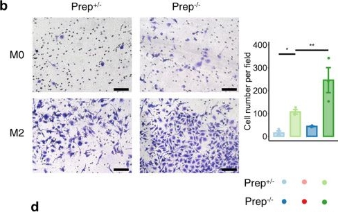 Fig.6.B showing Immunohistochemistry in a Mus musculus (House mouse) sample from the publication: Prolyl endopeptidase remodels macrophage function as a novel transcriptional coregulator and inhibits fibrosis.