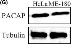 Fig.2.G showing Western Blotting from the publication: Dedifferentiated Schwann cells promote perineural invasion mediated by the PACAP paracrine signalling in cervical cancer.
