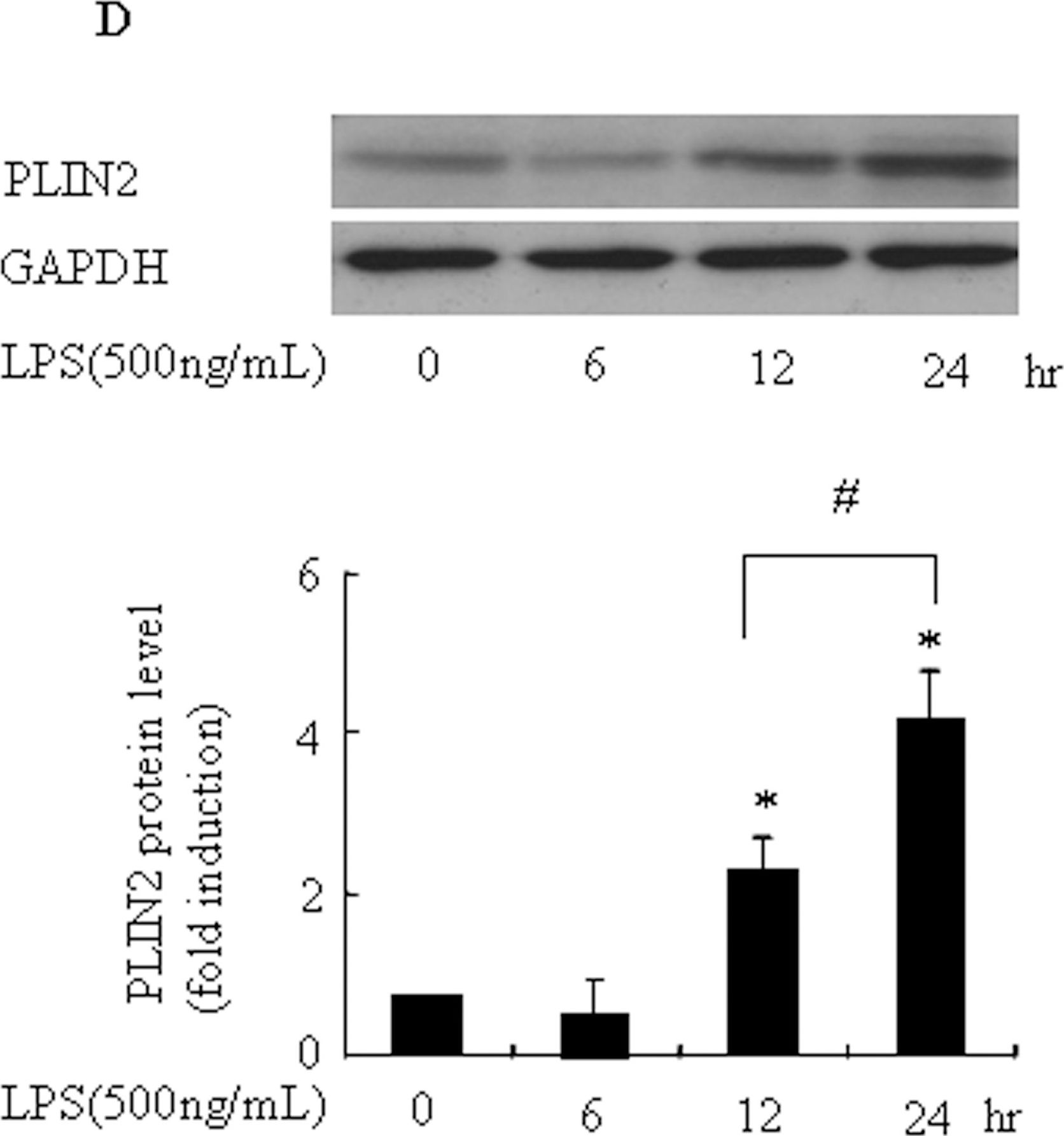 Pycnogenol Attenuates the Release of Proinflammatory Cytokines and Expression of Perilipin 2 in Lipopolysaccharide-Stimulated Microglia in Part via Inhibition of NF-κB and AP-1 Activation.