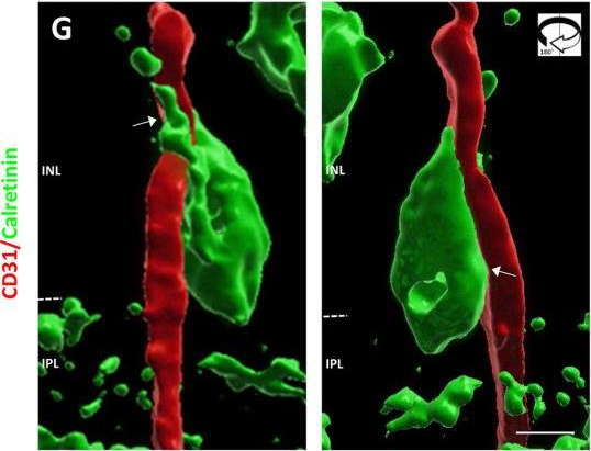 Fig.5.G showing Immunohistochemistry in a Mus musculus (House mouse) sample from the publication: In Utero Alcohol Exposure Impairs Retinal Angiogenesis and the Microvessel-Associated Positioning of Calretinin Interneurons.