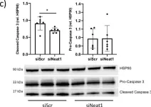Fig.2.C showing Western Blotting from the publication: Inhibition of the long non-coding RNA NEAT1 protects cardiomyocytes from hypoxia in vitro via decreased pri-miRNA processing.