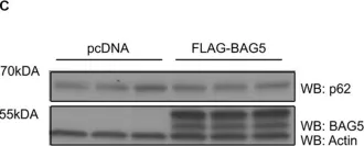 Fig.3.C showing Western Blotting from the publication: BAG5 Promotes Alpha-Synuclein Oligomer Formation and Functionally Interacts With the Autophagy Adaptor Protein p62.