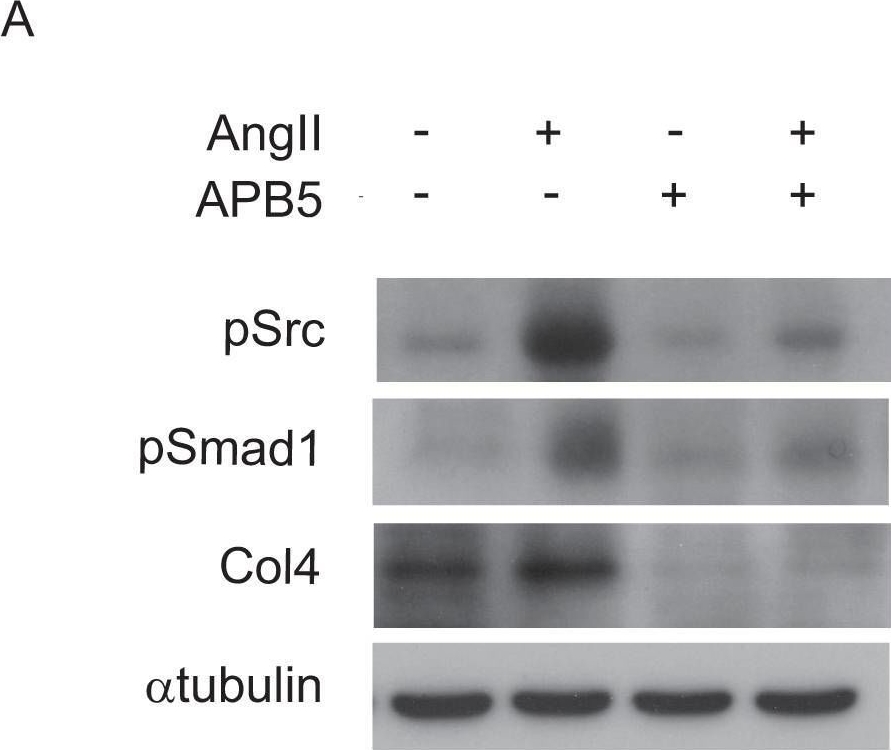 Activation of Src mediates PDGF-induced Smad1 phosphorylation and contributes to the progression of glomerulosclerosis in glomerulonephritis.