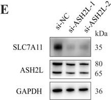 Fig.5.E showing Western Blotting from the publication: Targeting SLC7A11-mediated cysteine metabolism for the treatment of trastuzumab-resistant HER2-positive breast cancer.