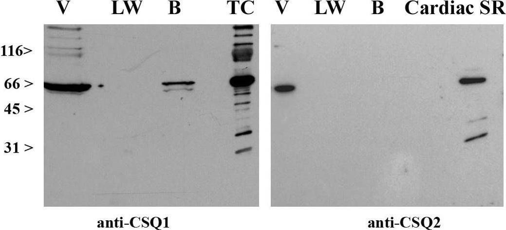 Fig.7.A showing Western Blotting in a Mus musculus (House mouse) sample from the publication: Role of the JP45-Calsequestrin Complex on Calcium Entry in Slow Twitch Skeletal Muscles.
