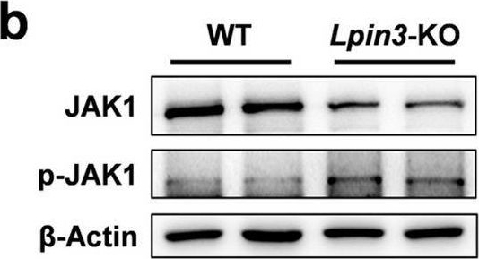 Fig.7.B showing Western Blotting in a Homo sapiens (Human) sample from the publication: Lipin3 deficiency promotes hepatocyte ferroptosis and pyroptosis via activating JAK1-STAT3 pathway during acetaminophen induced acute liver injury.