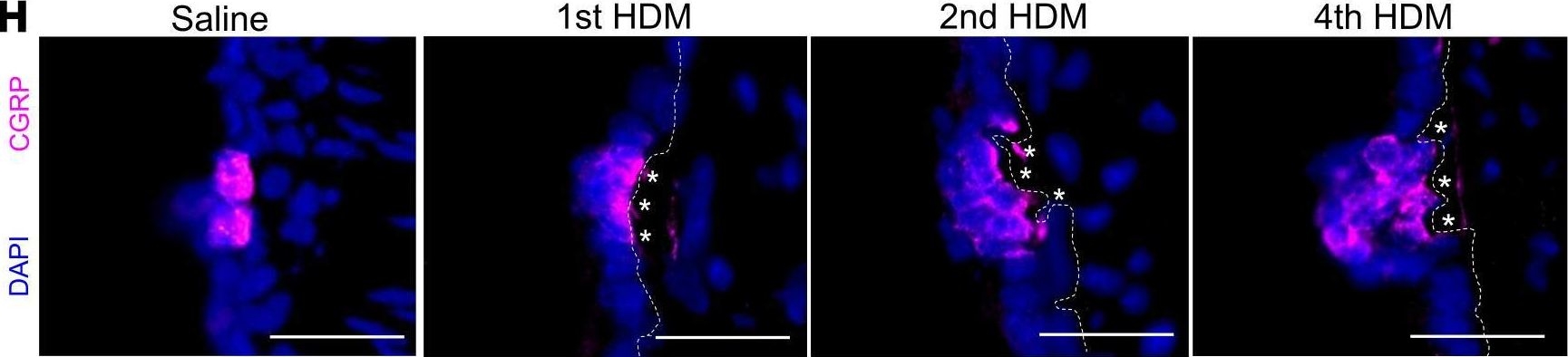 Fig.3.H showing Immunohistochemistry-immunofluorescence in a Mus musculus (House mouse) sample from the publication: Allergen induces pulmonary neuroendocrine cell hyperplasia in a model of asthma.
