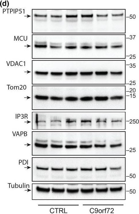 Fig.1.D showing Western Blotting in a Homo sapiens (Human) sample from the publication: Disruption of ER-mitochondria tethering and signalling in C9orf72-associated amyotrophic lateral sclerosis and frontotemporal dementia.