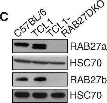 Fig.6.C showing Western Blotting in a Mus musculus (House mouse) sample from the publication: Extracellular Vesicle Secretion by Leukemia Cells In Vivo Promotes CLL Progression by Hampering Antitumor T-cell Responses.