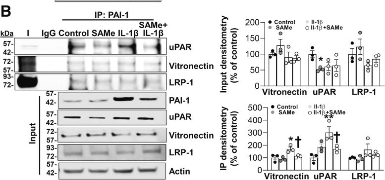 Fig.7.B showing Western Blotting in a Mus musculus (House mouse) sample from the publication: S-Adenosylmethionine Inhibits Plasminogen-Activating Inhibitor-1 and Protects Male Mice From FOLFOX-Induced Liver Injury.