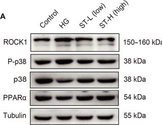 Fig.4.A showing Western Blotting from the publication: Stigmasterol-Mediated Targeting of Rho-Associated Coiled-Coil Protein Kinase 1 Ameliorates Diabetic Kidney Disease and Attenuates Renal Tubular Lipid Deposition.