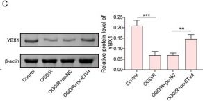 Fig.4.C showing Western Blotting in a Homo sapiens (Human) sample from the publication: ETV4 Improves Cerebral Ischemia-Reperfusion Injury by Restraining YBX1-GPX4-Ferroptosis Cascades.
