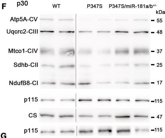 Fig.2.F showing Western Blotting in a Mus musculus (House mouse) sample from the publication: miR-181a/b downregulation: a mutation-independent therapeutic approach for inherited retinal diseases.