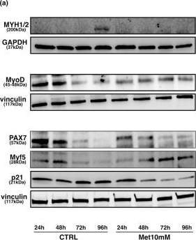 Fig.4.A showing Western Blotting in a Mus musculus (House mouse) sample from the publication: Metformin regulates myoblast differentiation through an AMPK-dependent mechanism.