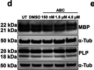 Fig.3.D showing Western Blotting from the publication: Exposure to Frontline Antiretroviral Dolutegravir Disrupts Oligodendrocyte Development Across Differentiation Stages.