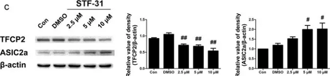 Fig.3.C showing Western Blotting from the publication: Glucose Deficiency Elevates Acid-Sensing Ion Channel 2a Expression and Increases Seizure Susceptibility in Temporal Lobe Epilepsy.
