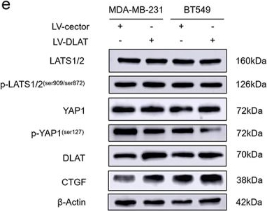 Fig.4.E showing Western Blotting in a Homo sapiens (Human) sample from the publication: DLAT promotes triple-negative breast cancer progression via YAP1 activation.