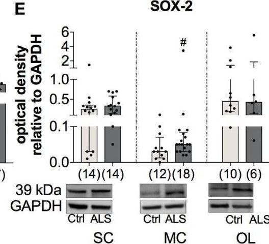 Fig.10.E showing Western Blotting from the publication: The TGF-β System As a Potential Pathogenic Player in Disease Modulation of Amyotrophic Lateral Sclerosis.