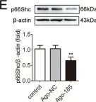 Fig.4.E showing Western Blotting from the publication: circ-CBFB upregulates p66Shc to perturb mitochondrial dynamics in APAP-induced liver injury.