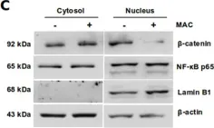 Fig.2.C showing Western Blotting in a Homo sapiens (Human) sample from the publication: Targeting the Endothelin-1 pathway to reduce invasion and chemoresistance in gallbladder cancer cells.