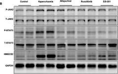 Phospho-Tyk2 (Tyr1054/1055) (D7T8A) Rabbit mAb | Cell