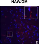 Fig.7.D showing Immunohistochemistry-immunofluorescence in a Mus musculus (House mouse) sample from the publication: IFN-gamma signaling in the central nervous system controls the course of experimental autoimmune encephalomyelitis independently of the localization and composition of inflammatory foci.