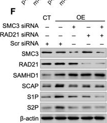 Fig.8.F showing Western Blotting from the publication: Hepatocyte SAMHD1 Deficiency Attenuates Hepatic Steatosis via Suppression of SREBP Activation in a Mouse Model of Metabolic-Associated Steatotic Liver Disease.