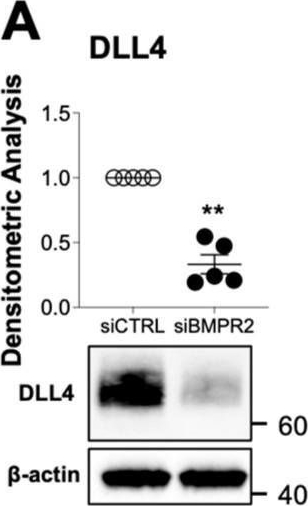 Fig.4.A showing Western Blotting from the publication: BMPR2 Loss Activates AKT by Disrupting DLL4/NOTCH1 and PPARγ Signaling in Pulmonary Arterial Hypertension.