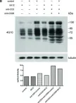 Fig.7.B showing Western Blotting in a Homo sapiens (Human) sample from the publication: Involvement of HAb18G/CD147 in T cell activation and immunological synapse formation.