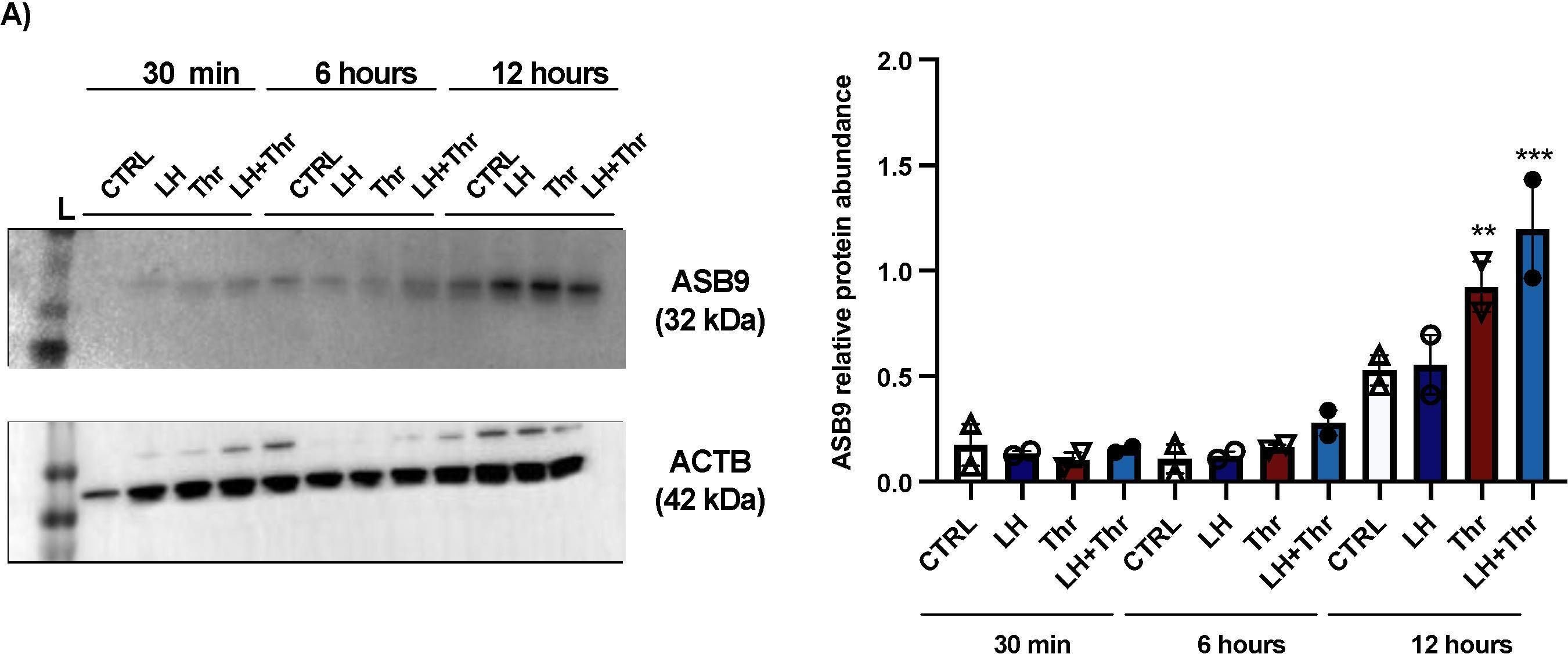 Fig.2.A showing Western Blotting from the publication: The Negative Role of Ankyrin-Repeat and SOCS-Box Protein 9 in PAR1 Expression and the MAPK Signaling Pathway in Bovine Granulosa Cells.