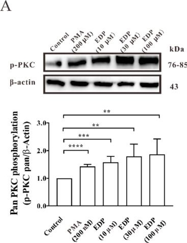 Fig.4.A showing Western Blotting in a Rattus norvegicus (Rat) sample from the publication: Glucose Uptake Is Increased by Estradiol Dipropionate in L6 Skeletal Muscle Cells.