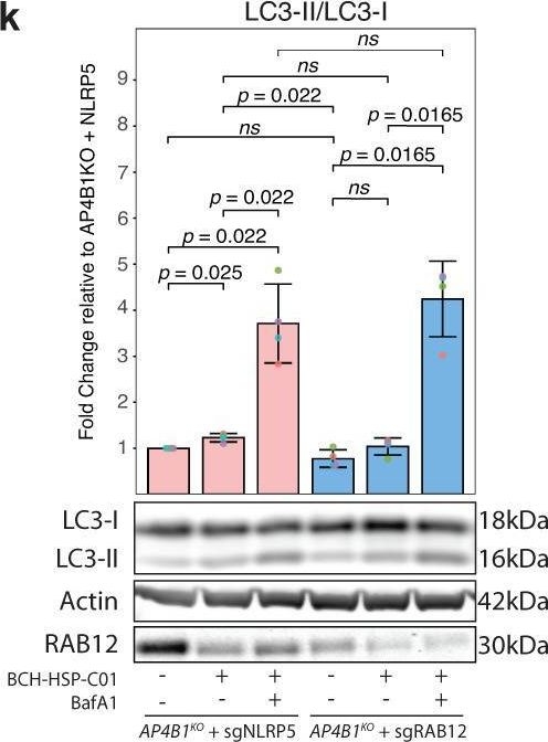 Fig.8.K showing Western Blotting in a Homo sapiens (Human) sample from the publication: High-content screening identifies a small molecule that restores AP-4-dependent protein trafficking in neuronal models of AP-4-associated hereditary spastic paraplegia.
