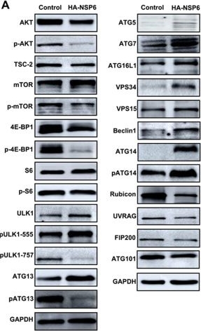 Fig.1.A showing Western Blotting from the publication: SARS-CoV-2 NSP6 reduces autophagosome size and affects viral replication via sigma-1 receptor.