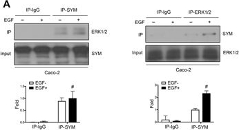 Nuclear accumulation of symplekin promotes cellular proliferation and dedifferentiation in an ERK1/2-dependent manner.
