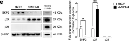 Fig.5.E showing Western Blotting from the publication: Targeting MDM4 as a Novel Therapeutic Approach in Prostate Cancer Independent of p53 Status.