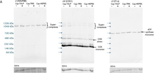 Fig.5.A showing Western Blotting from the publication: Medium Composition Determines the Dynamics of Boar In Vitro Sperm Capacitation-Associated Events.