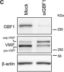 Fig.2.C showing Western Blotting from the publication: A GBF1-Dependent Mechanism for Environmentally Responsive Regulation of ER-Golgi Transport.