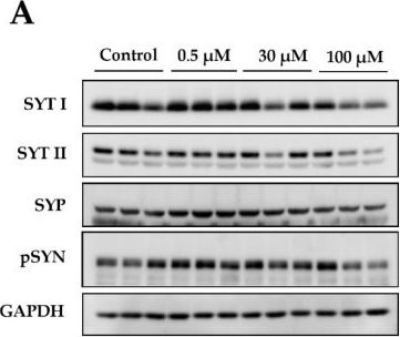 Fig.2.A showing Western Blotting in a Mus musculus (House mouse) sample from the publication: Hormetic-Like Effects of L-Homocysteine on Synaptic Structure, Function, and Aβ Aggregation.