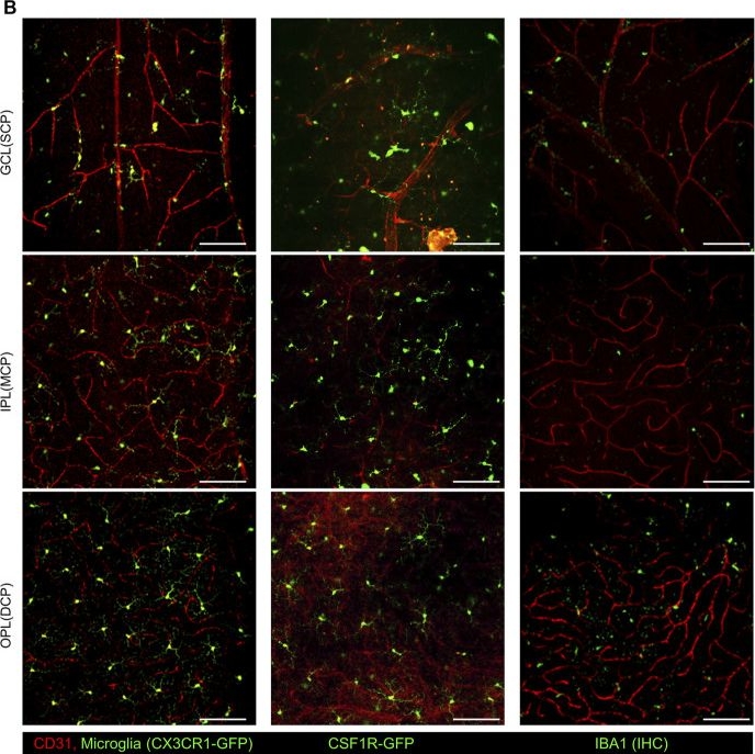 Fig.1.B showing Immunocytochemistry-immunofluorescence from the publication: Deciphering perivascular macrophages and microglia in the retinal ganglion cell layers.